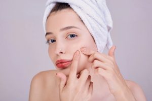 phân biệt mụn viêm và mụn không viêm
