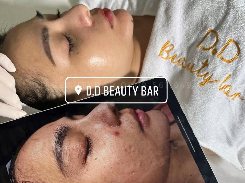 D.D Beauty Bar - Chuyên cung cấp dịch vụ chăm sóc da uy tín tại TP.HCM