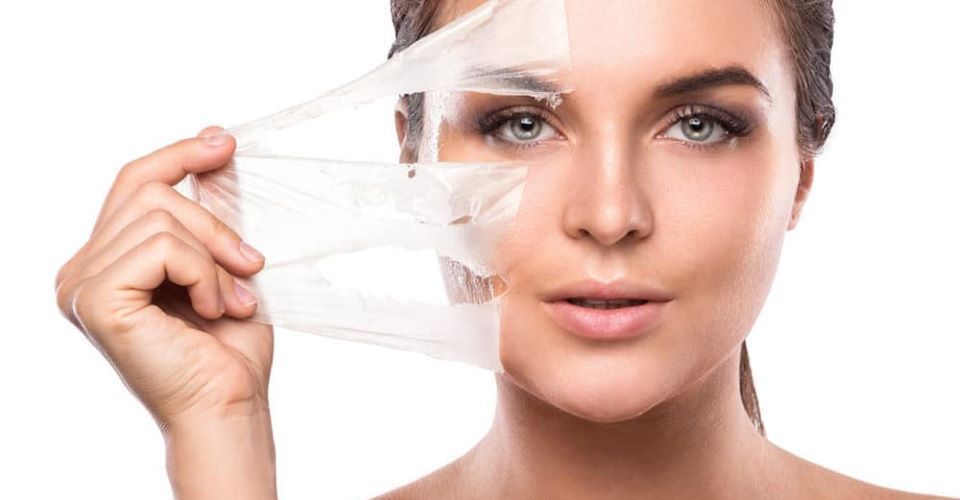 Khi nào nên lựa chọn peel da?