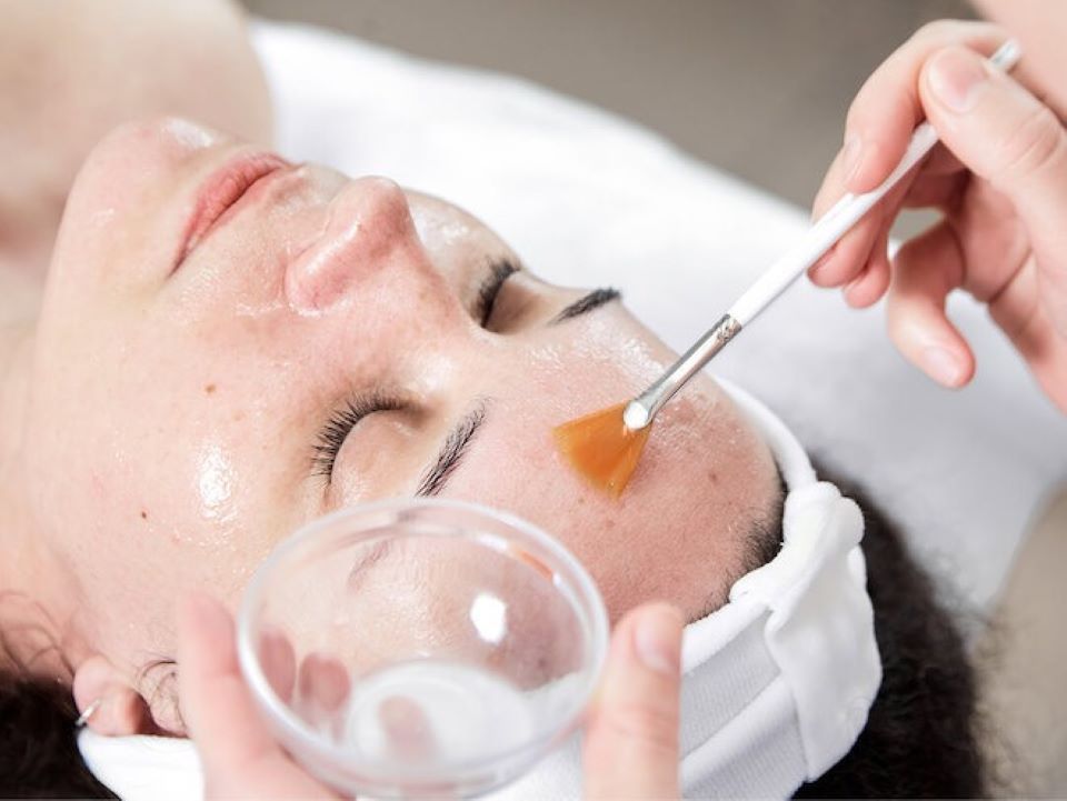Lưu ý khi thực hiện peel da căng bóng