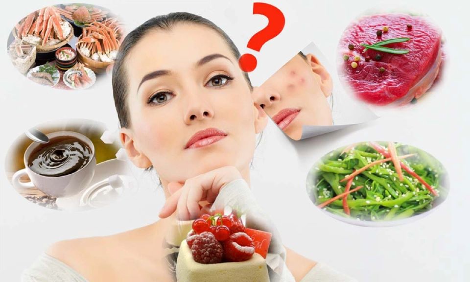 Nguyên tắc xây dựng chế độ dinh dưỡng cho da mụn