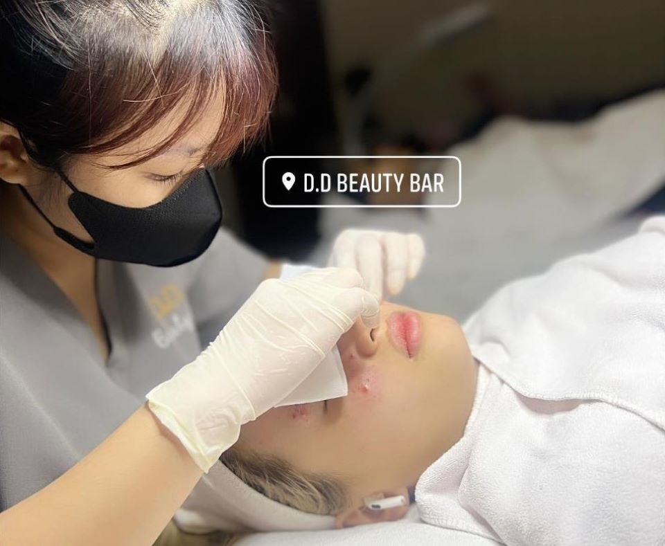 Lấy nhân mụn chuẩn y khoa tại D.D Beauty Bar
