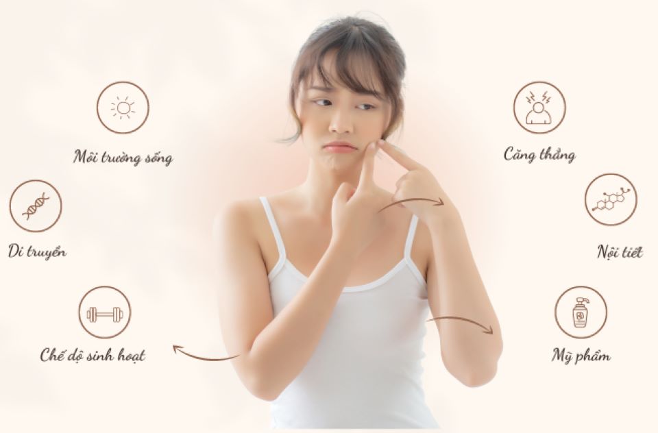 Kiến thức chuyên sâu về da mụn: Nguyên nhân gây mụn phổ biến