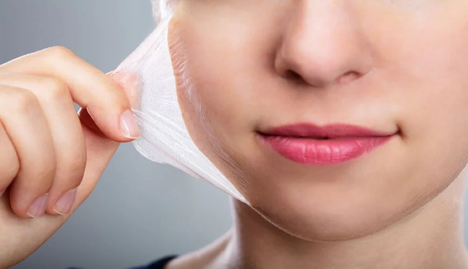 Da dầu mụn có nên peel da không? - Các phương pháp peel da phù hợp cho da dầu mụn
