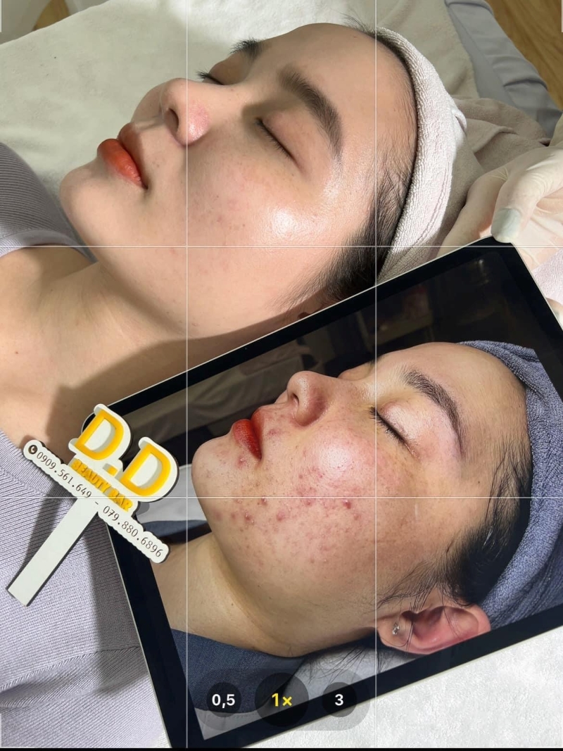 Chăm sóc da tại D.D Beauty Bar