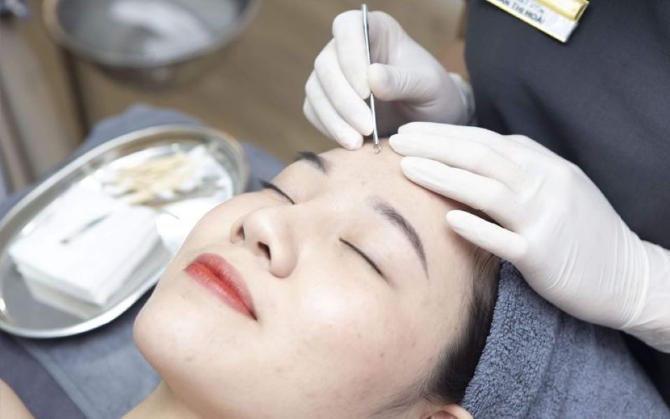 Có nên lấy nhân mụn không? Lấy nhân mụn có hết mụn không?