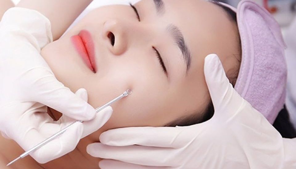 Lấy nhân mụn chuẩn y khoa