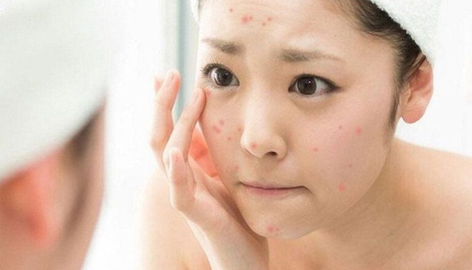 Các trường hợp da không thể tự hồi phục